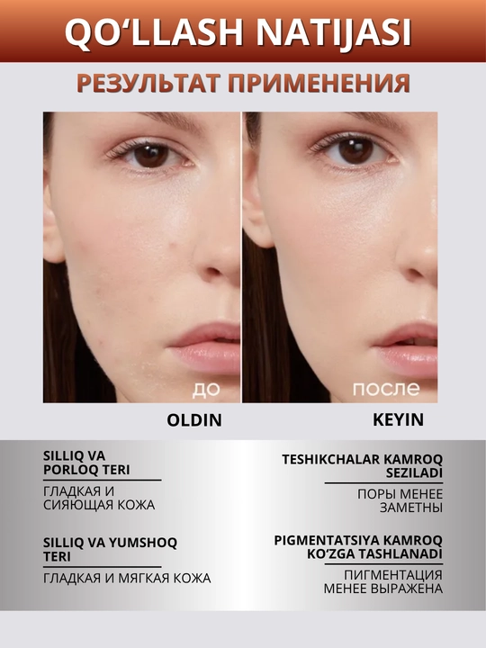 ICON SKIN terini yangilash uchun kislotalar va peptidlar bilan professional piling, 30 ml