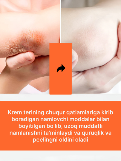 Отбеливающий крем для лица и тела, против веснушек, постакне и пигментации, витамин С