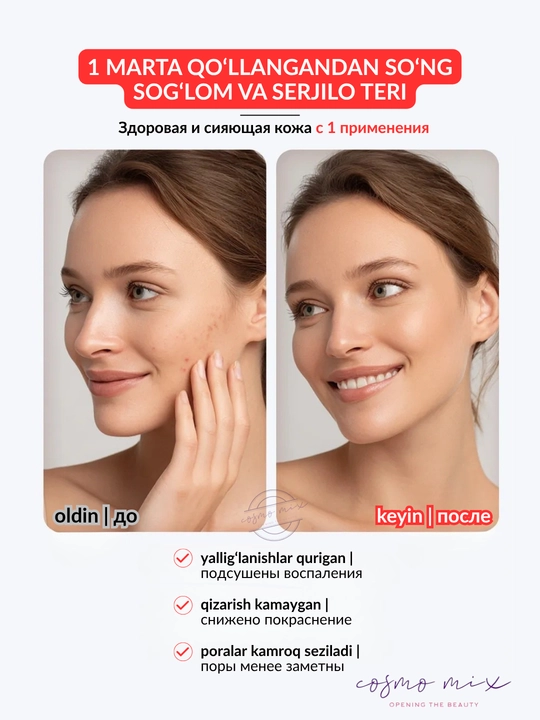 Сыворотка для проблемной кожи лица, 30 мл – MIXIT Skin Chemistry Stop Acne Face Serum