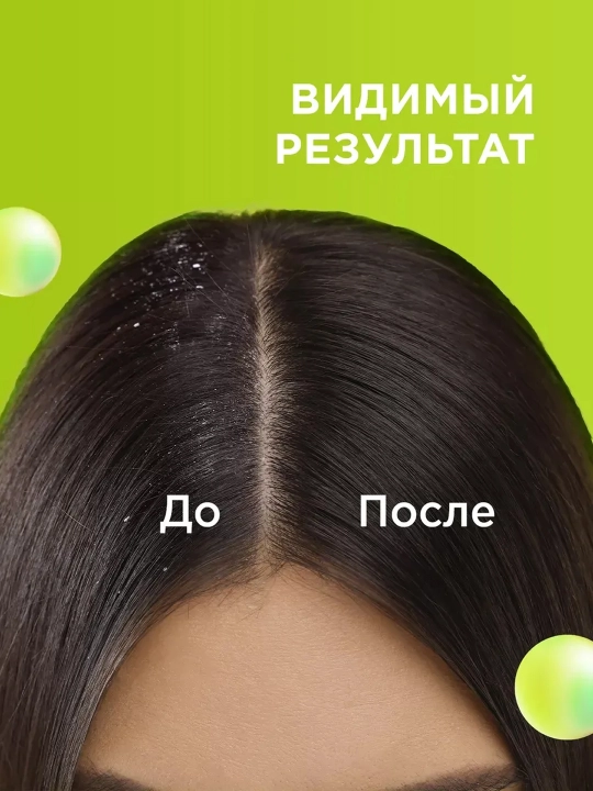MYMUSE шампунь-бальзам против перхоти 2 в 1, 400 мл