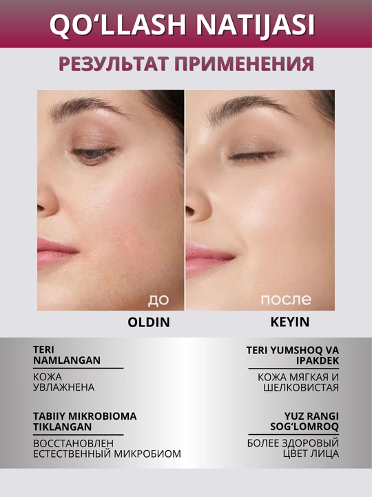 ICON SKIN Yuz uchun namlantiruvchi krem, sezgir teri uchun probiotiklar bilan, 30 ml