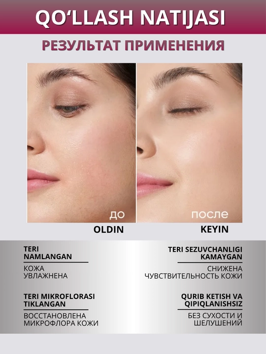 ICON SKIN Yuz uchun namlantiruvchi krem, sezgir teri uchun probiotiklar bilan, 30 ml