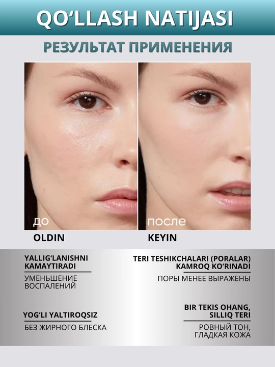 ICON SKIN yuz serumi — namlash, tiklash, taranglik va lifting, 30 ml