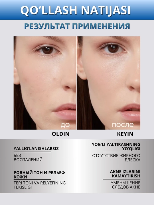 ICON SKIN yuz serumi — namlash, tiklash, taranglik va lifting, 30 ml
