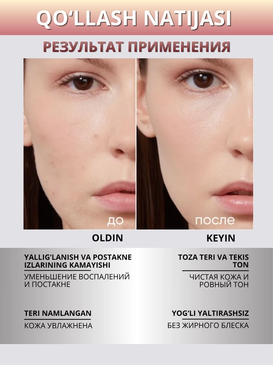 ICON SKIN yuz serumi — namlash, tiklash, taranglik va lifting, 30 ml