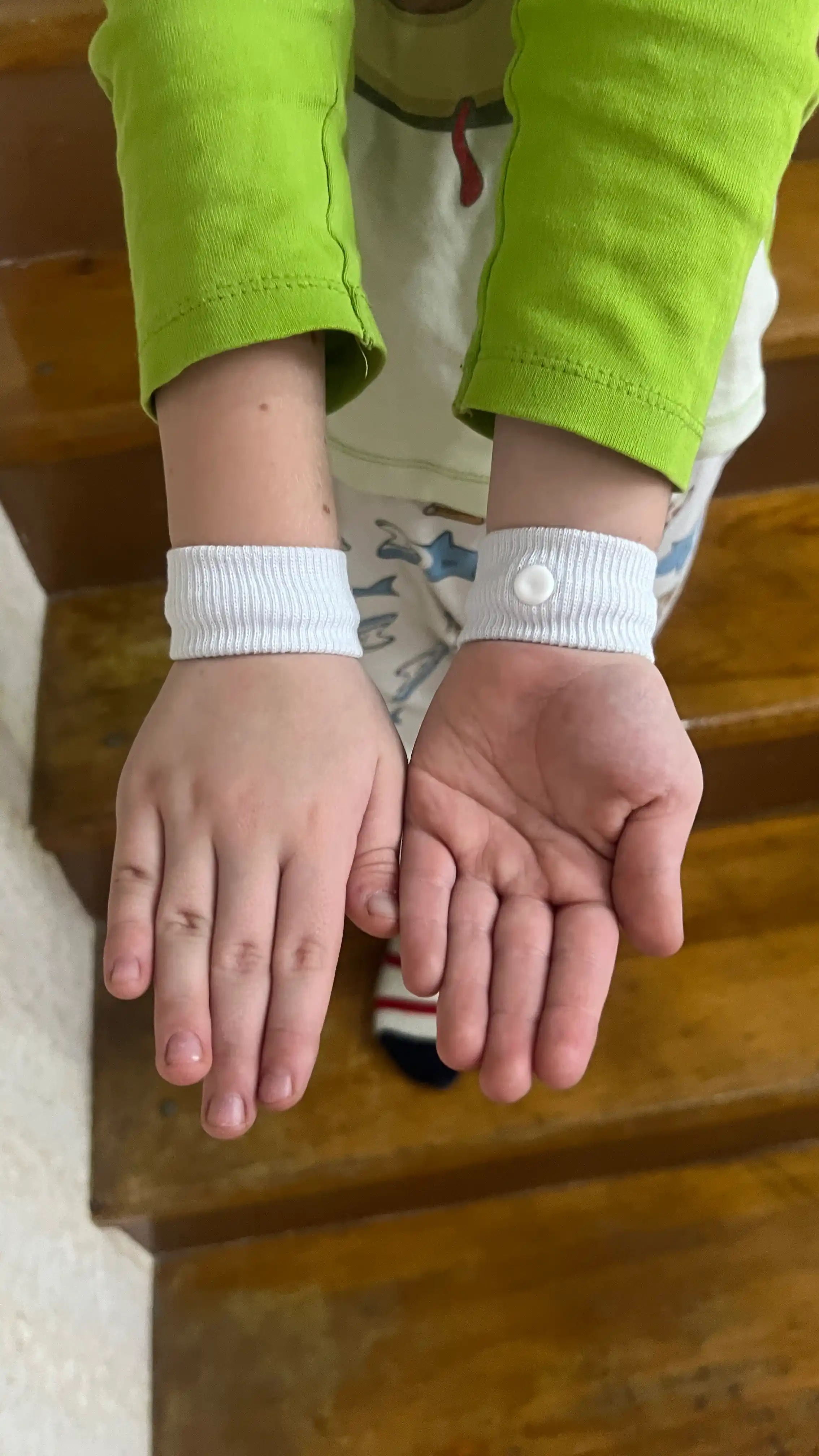 Harakat kasalligi va ko'ngil aynishi uchun bilaguzuk, 2 ta akupunktur bilaguzuk