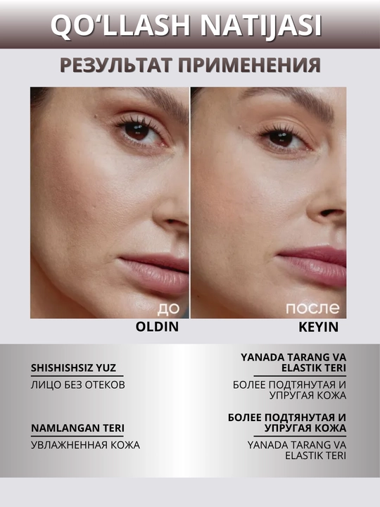 ICON SKIN Тоник для лица- увлажнение, сияние, лимфодренаж, анти-акне, защита кожи, 150 мл