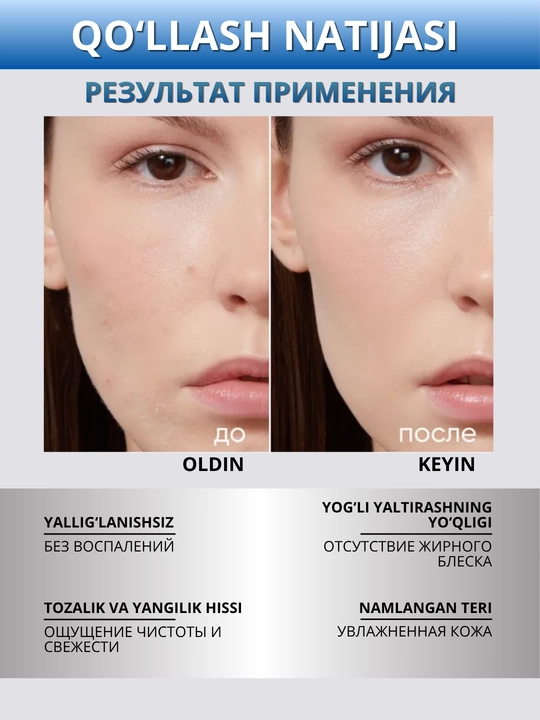 ICON SKIN Тоник для лица- увлажнение, сияние, лимфодренаж, анти-акне, защита кожи, 150 мл