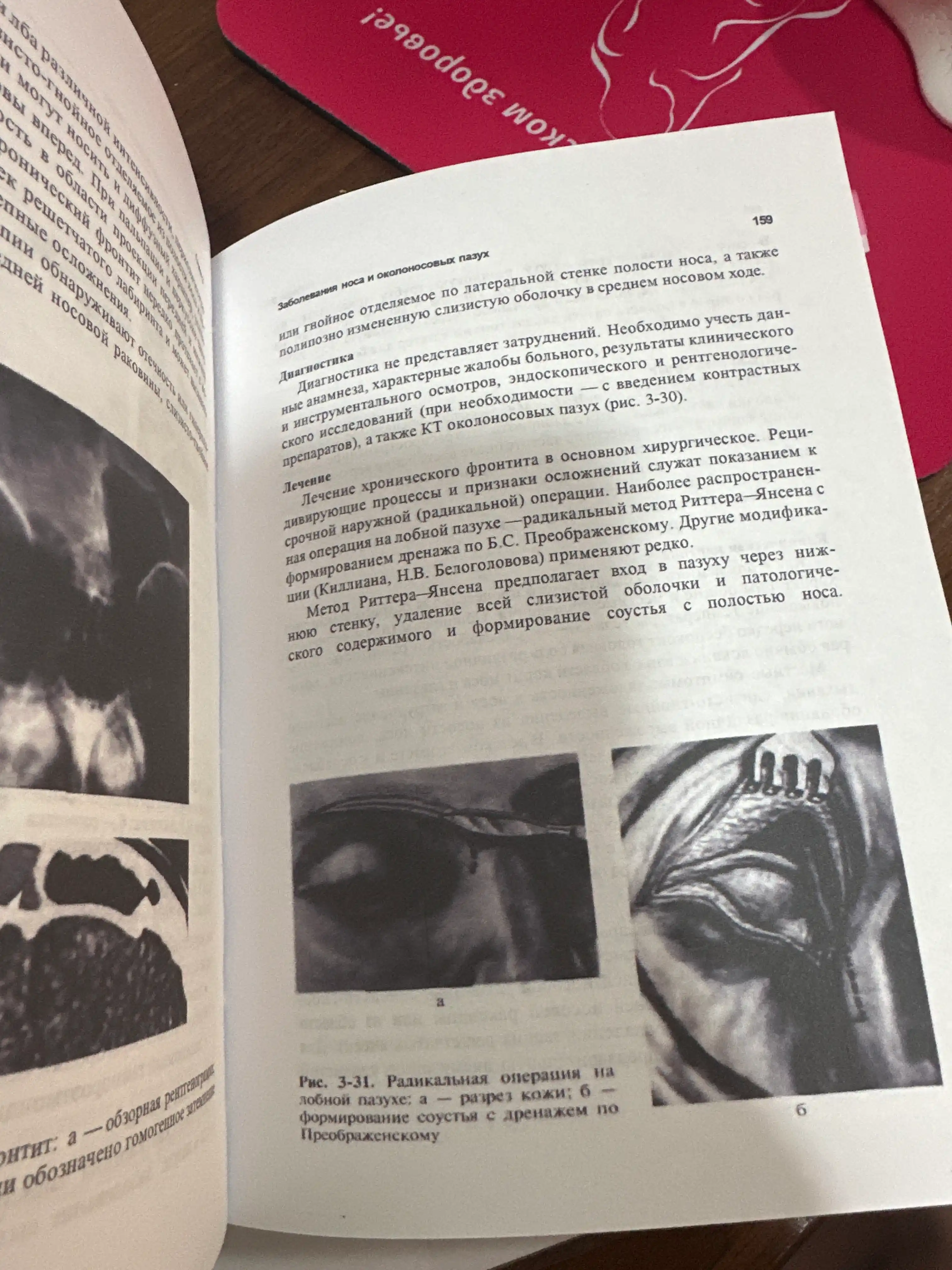 Otorinolaringologiya: Uchebnik. 4-e izd. V.T. Palchun, A.I. Kryukov, M.M. Magomedov