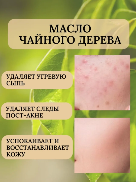 Сыворотка для лица против акне Sadoer, с маслом чайного дерева, 30 мл