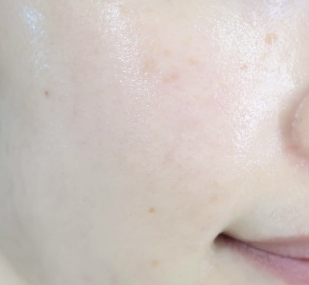 PDRN bilan VT Cosmetics yuz uchun zardobi, yoshartiruvchi, mustahkamlovchi, peptidlar va seramidlar bilan