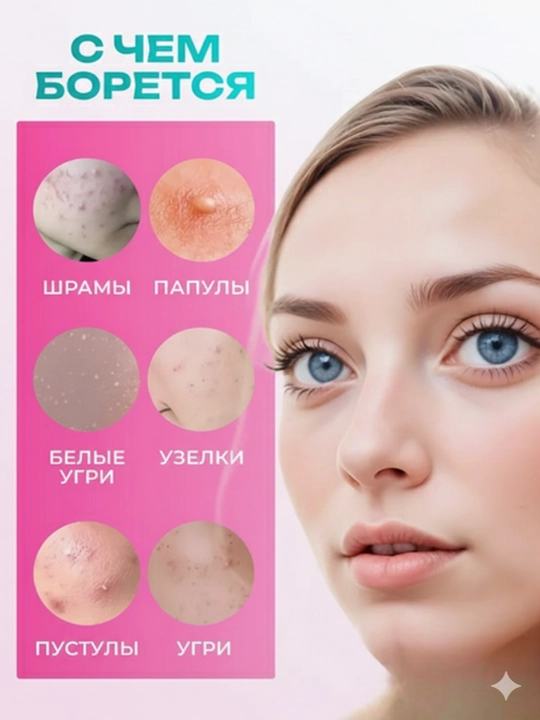 Патчи от прыщей на лице Patch Acne, гидроколлоидные, 36, 180 шт