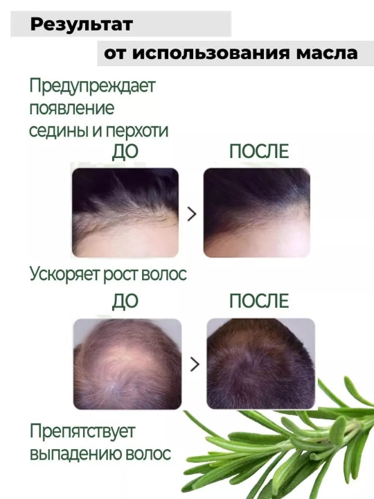 Rozmarin yog`i efir, soch, soqol, qosh kirpiklar uchun