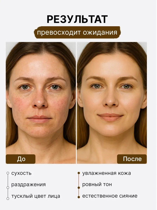 Сыворотка для лица восстанавливающая SKIN1004 Madagascar Centella Probio-Cica Intensive