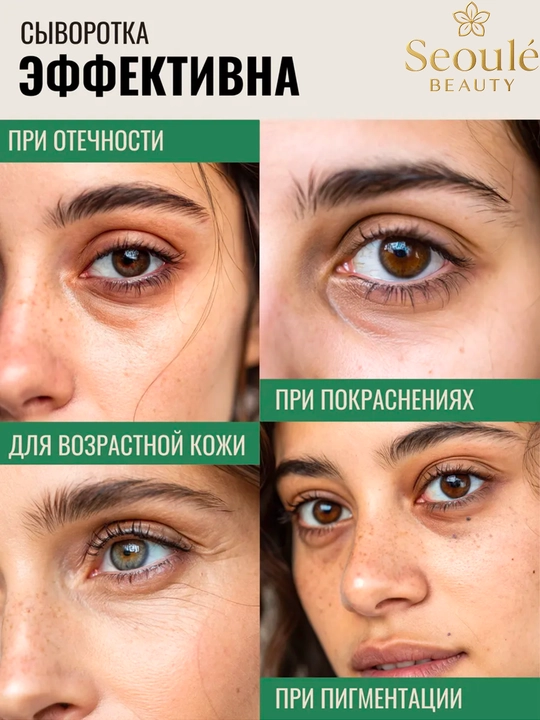 Axis Y, Spot Correcting Glow Serum, Eye Serum, Axis Penka, AXIS-Y TXA 2.5% va Axis nabor
