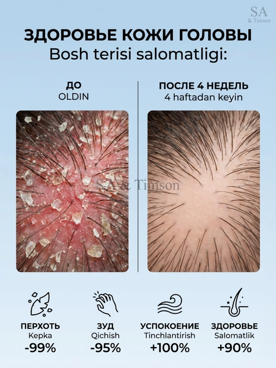Timson C HASERVEY shampuni, mustahkamlaydigan, qazg'oqqa qarshi