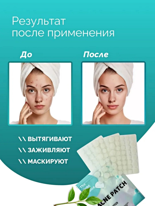 Патчи от прыщей на лице Patch Acne, гидроколлоидные, 36, 180 шт