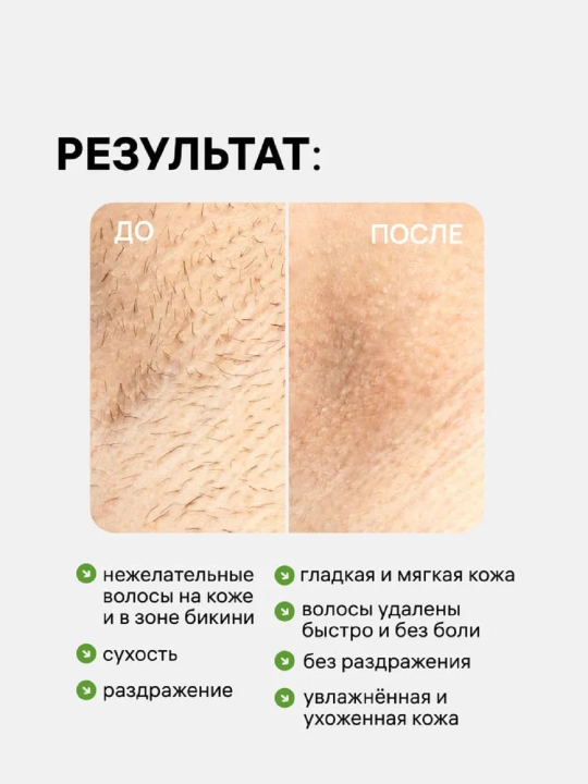 Depilyatsiya uchun, sochlarni olib tashlash uchun, sezgir teri uchun bikini va oyoq uchun krem, 100 ml