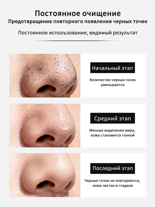 LYDIMOON Mask qora nuqtalarni yo'qotish uchun, 60 g