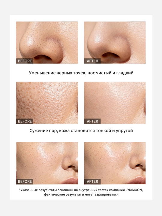 LYDIMOON Mask qora nuqtalarni yo'qotish uchun, 60 g