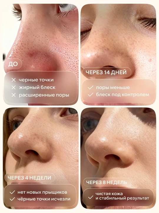 Сыворотка для лица, для сужения пор SKIN1004 Madagascar Centella Poremizing Fresh Ampoule