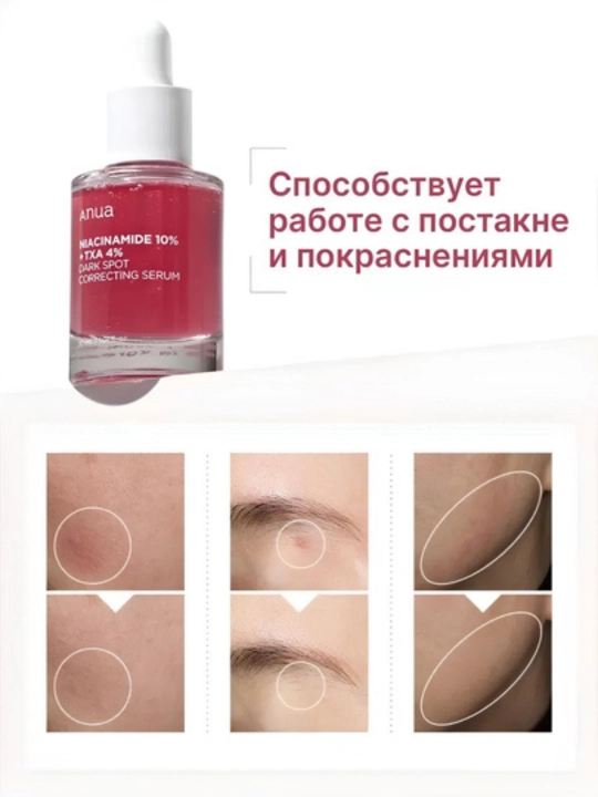 Сыворотки от Anua