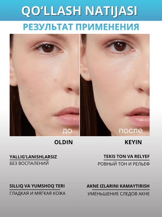 ICON SKIN terini yangilash uchun kislotalar va peptidlar bilan professional piling, 30 ml