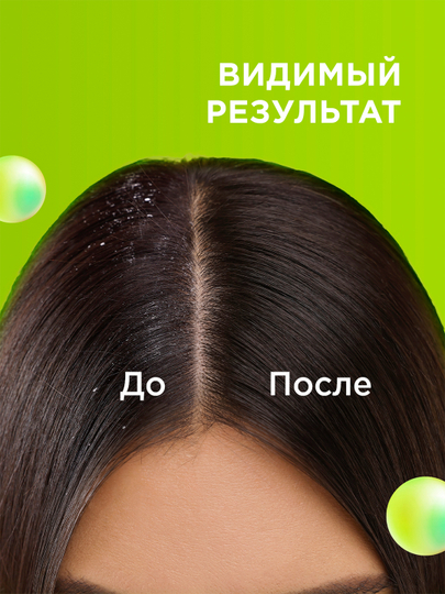 Шампунь и бальзам - ополаскиватель 2 в 1 против перхоти MYMUSE (в коробке 4 шт по 400мл)