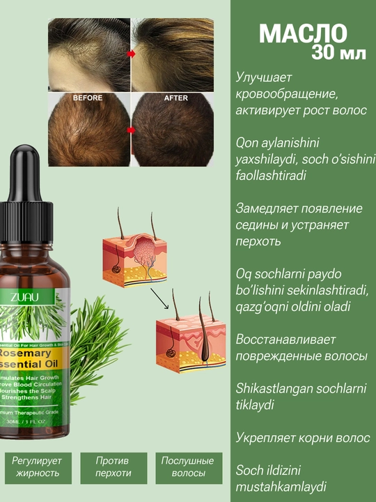 Rozmarin yog'i: Soch o'stiruvchi va to'kilishiga qarshi vosita, qazg'oqqa qarshi, 30 ml