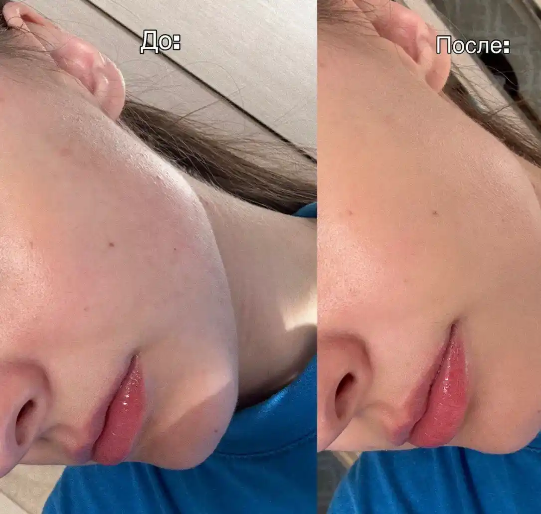 ББ крем для лица, увлажняющий тон №1 LIMONI Aquamax Moisture BB Cream, 40 мл