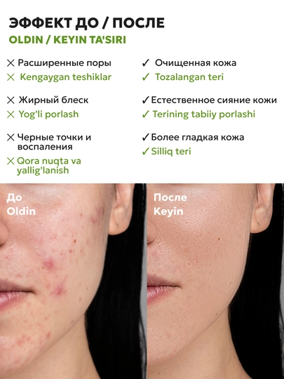 Маска для лица энзимная,от черных точек и прыщей,маски для лица с детокс-эффектом, SEMILY