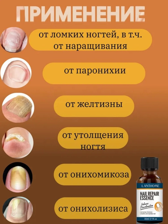 Раствор для лечения грибка ногтей, 30 мл, решает 97% проблем