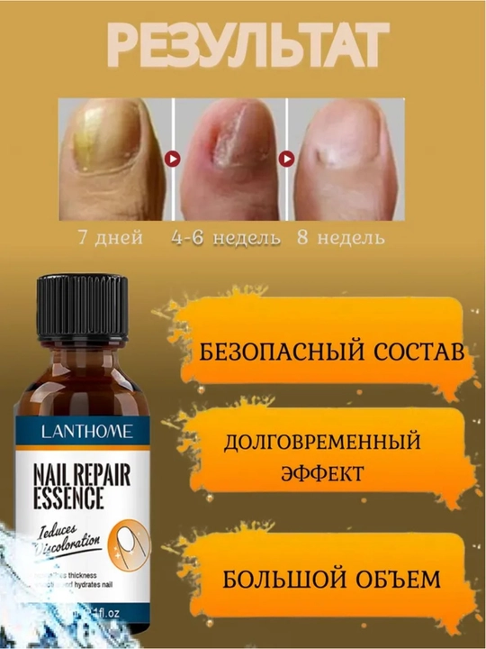 Раствор для лечения грибка ногтей, 30 мл, решает 97% проблем