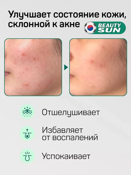 Husnbuzar va akne uchun yuvinish ko‘pigi, sentella bilan, Some by mi, Aha, Bha, pha 30 days, 100 ml