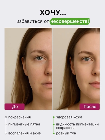Azelain va Gialuron kislotasi bilan tinchlantiruvchi zardob Anua Azelaic Acid 10+
