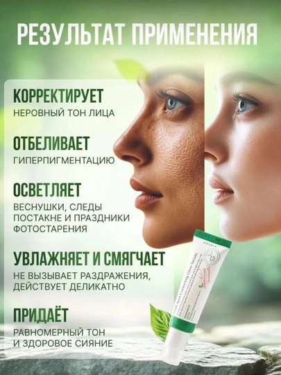 AXIS-Y Dark Spot Serum – niacinamidli dog‘larni yo‘qotuvchi va terini yorituvchi serum - 