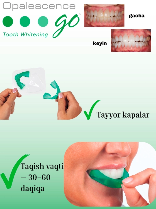 Oqartiruvchi gel Opalescence GO