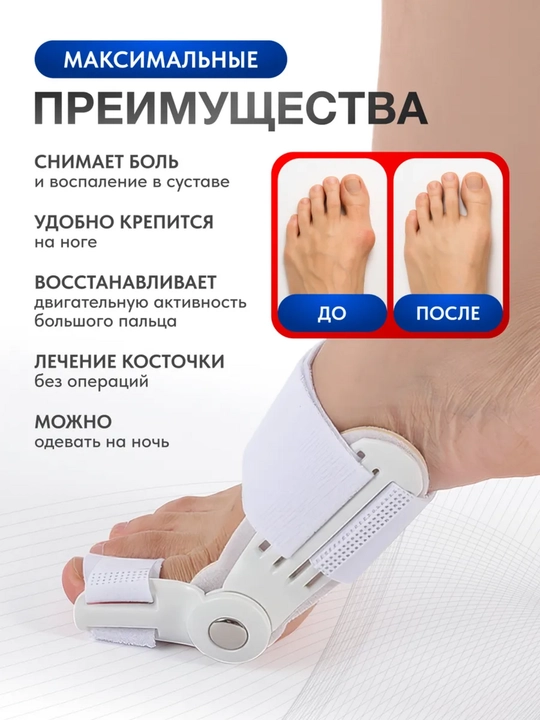 Valgus korrектор — oyoq barmoqlaridagi bo‘g‘im shinası