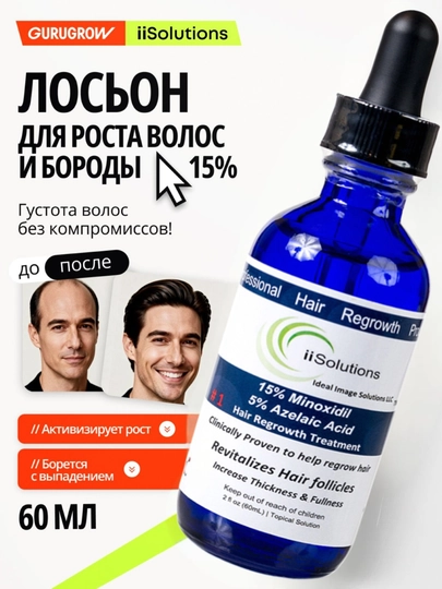 Лосьон для роста волос и бороды Minoxidil 15% iiSolutions, против выпадения, 60 мл - 