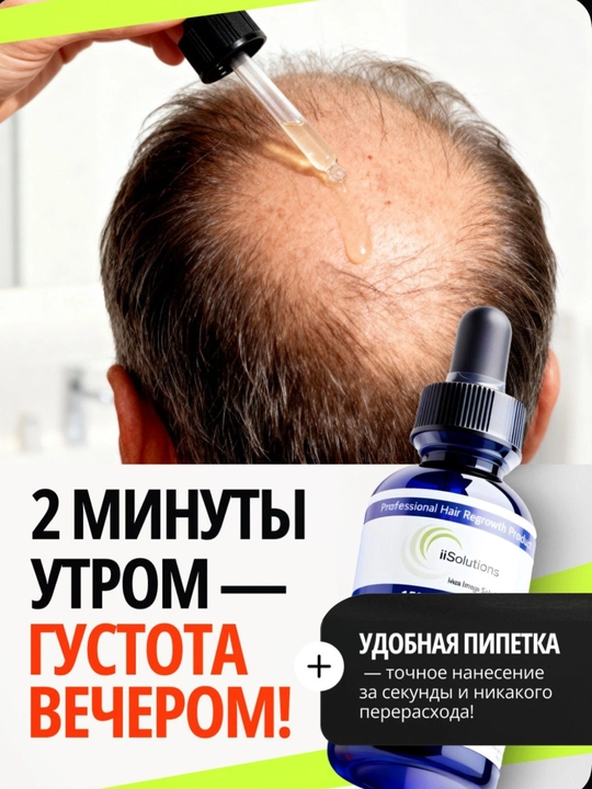Лосьон для роста волос и бороды Minoxidil 15% iiSolutions, против выпадения, 60 мл