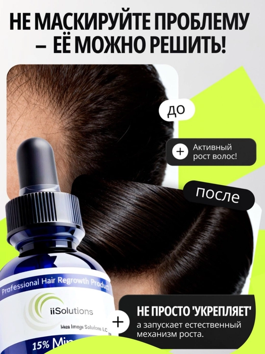 Лосьон для роста волос и бороды Minoxidil 15% iiSolutions, против выпадения, 60 мл