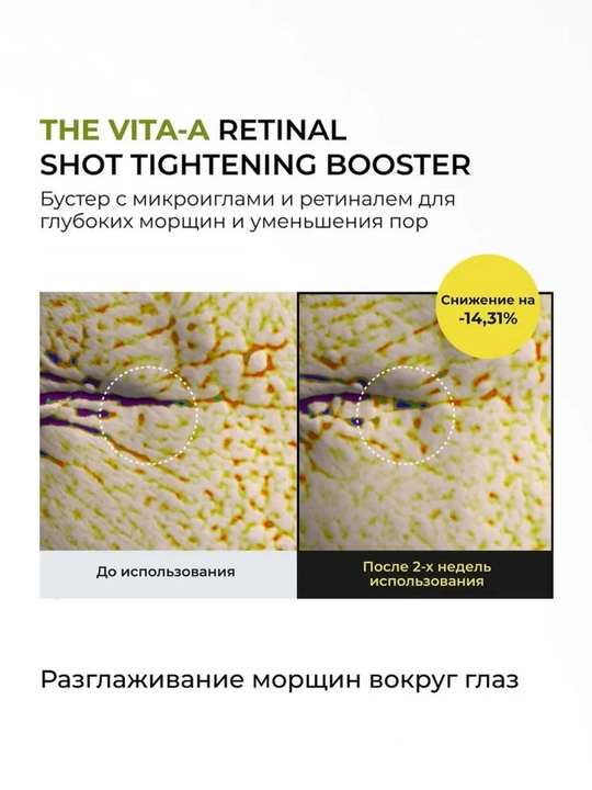 Yoshartiruvchi retinal zardobli buster Celimax Retinal Shot Tightening Booster, 15 ml
