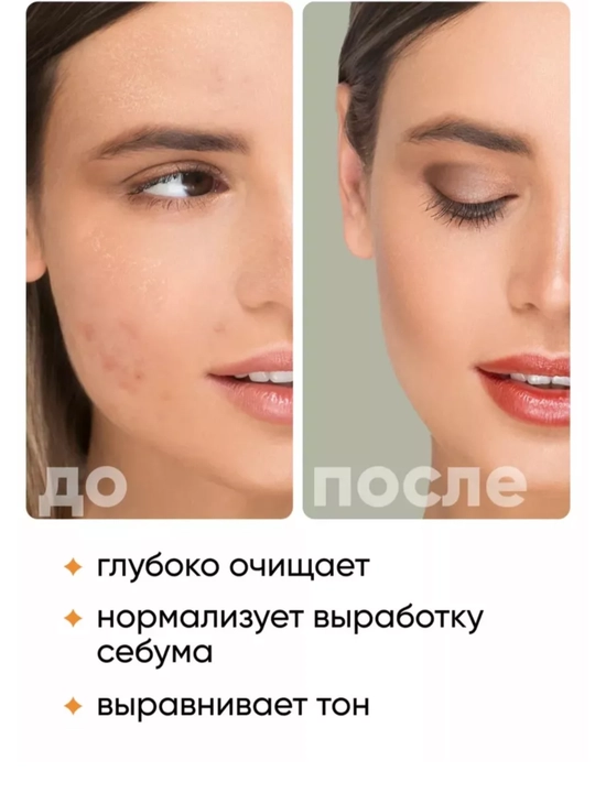 Пенка для умывания лица Bioaqua, oчищающая, увлажняющая, с массажной щеткой