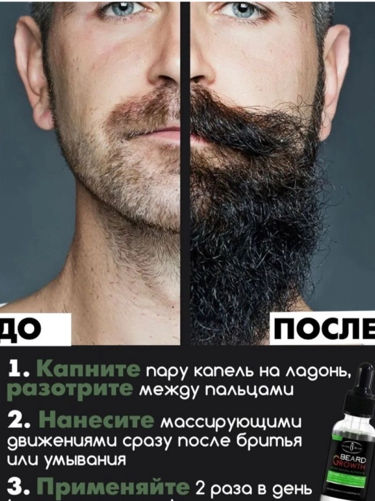 Beard Growth yog‘i — soqol o‘stiruvchi serum, vitaminli kompleks