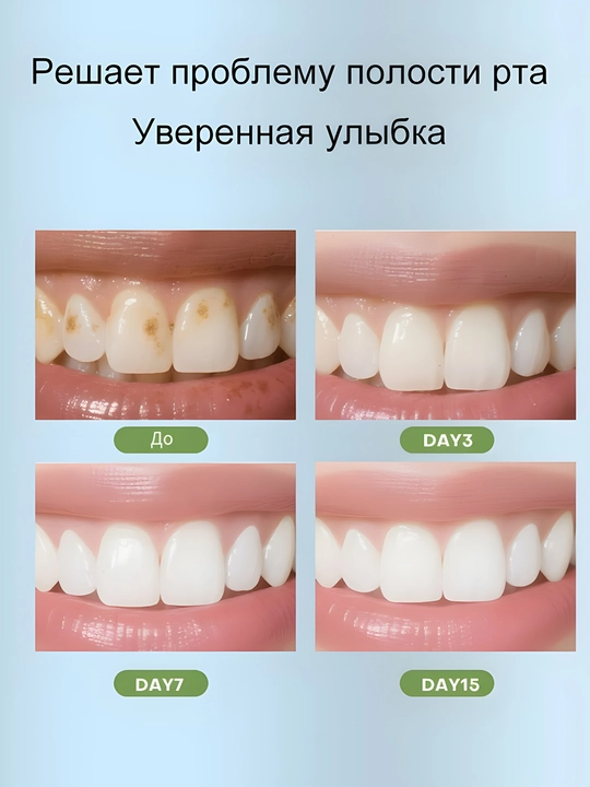 Набор для эффективного отбеливания зубов — 30 г