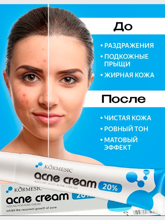 Крем от прыщей и акне 20% азелаиновая кислота, точечное средство, 20 г