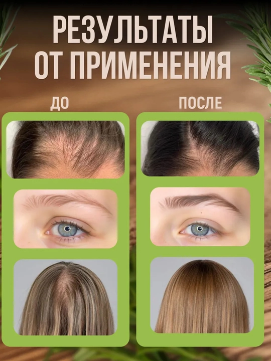 Soch va soqol o'stirish uchun rozmarin yog'i AYA, to'kilishiga qarshi serum, 30 ml