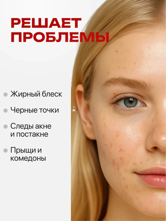 Кровавый пилинг для лица кислотный AHA BHA от прыщей, постакне и рубцов