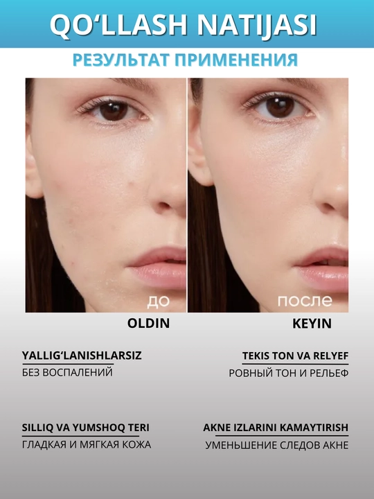 ICON SKIN terini yangilash uchun kislotalar va peptidlar bilan professional piling, 30 ml