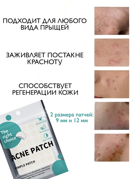 Yuz uchun akne va yiringli ugrilarga qarshi ta'sir etuvchi patchlar, 36 dona
